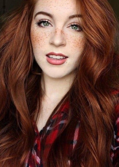 Freckles are more frequent among redheads due to tendency to have fair skin.