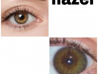 Do you have hazel eyes or central heterochromia?