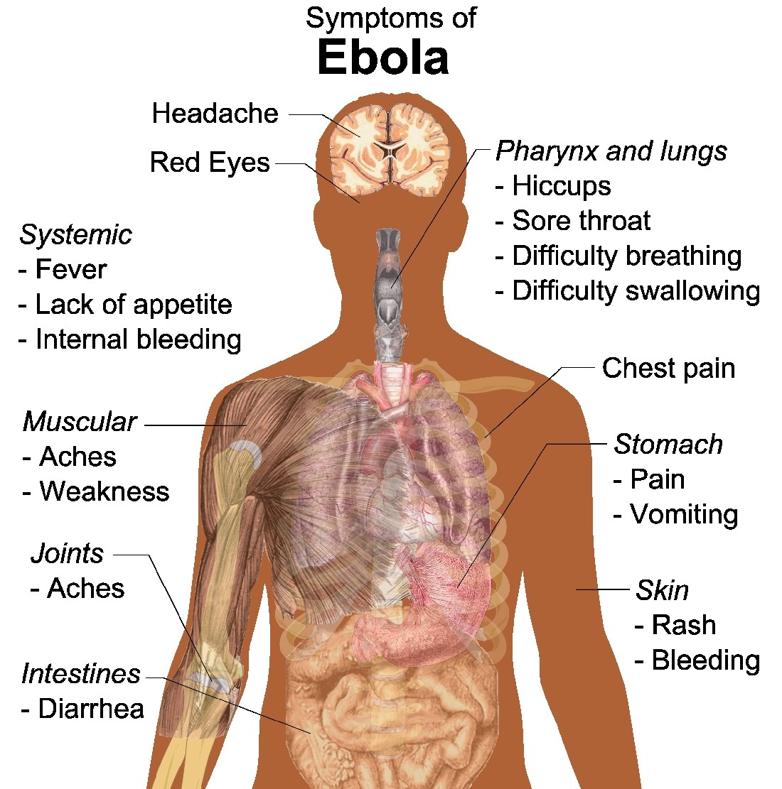 ...that persons with negative Rhesus group generally are infected less and survive more than those with a positive Rhesus group in the event of Ebola exposure, particularly if they are of blood group A. https://pst.cr/JN6Ma