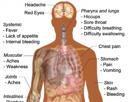 ...that persons with negative Rhesus group generally are infected less and survive more than those with a positive Rhesus group in the event of Ebola exposure, particularly if they are of blood group A. https://pst.cr/JN6Ma