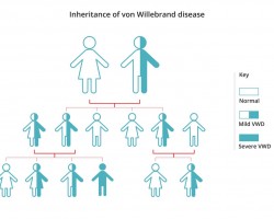 Von Willebrand disease low among people with blood type O
#vonWillebrand #rhnegative #bloodtype
https://www.rhesusnegative.net/staynegative/von-willebrand-disease-low-among-people-with-blood-type-o/