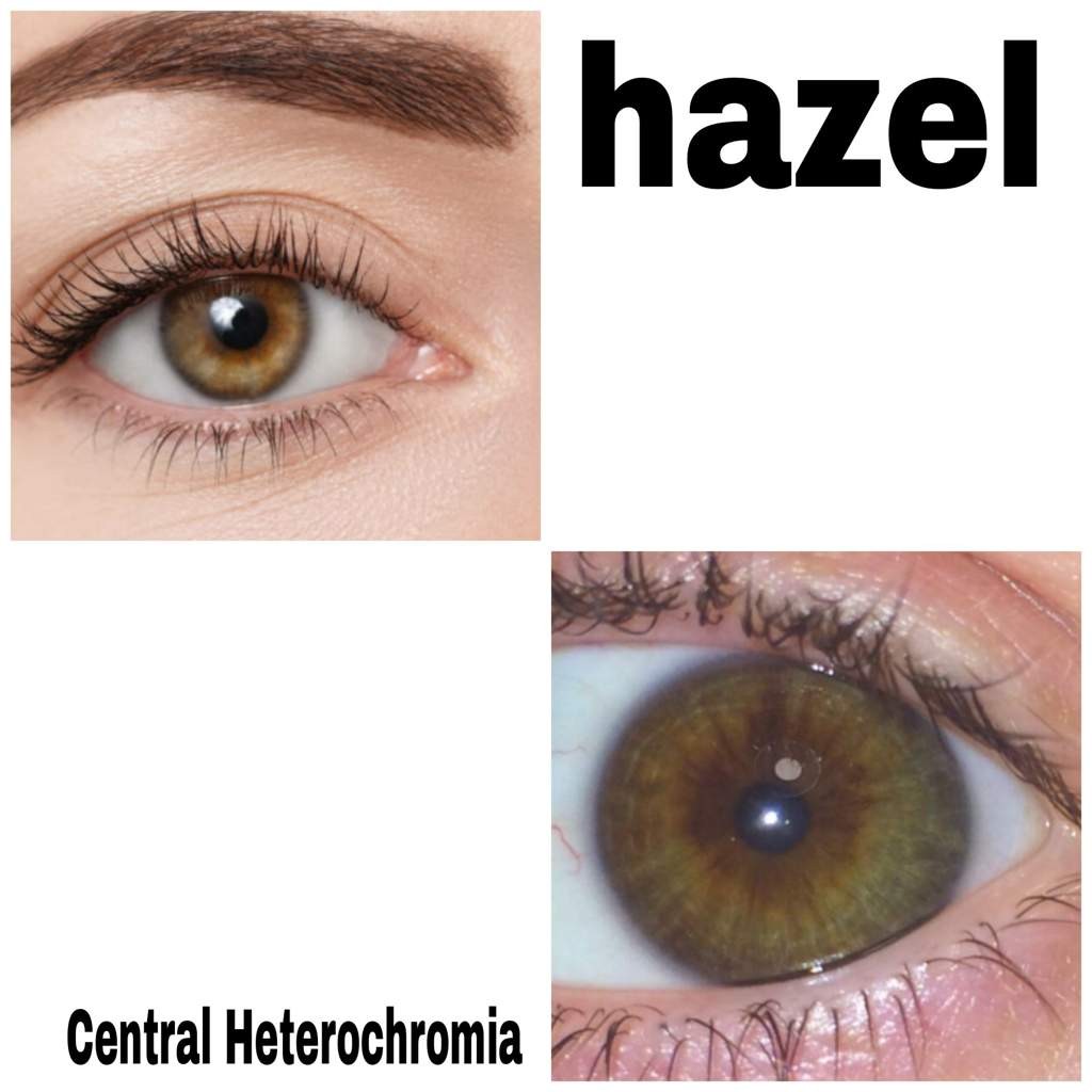 Do you have hazel eyes, central heterochromia, neither or both?... AND... are you Rh negative?