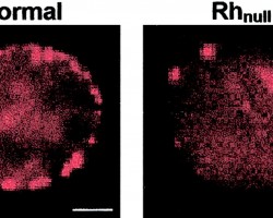 How frequent is Rh null?