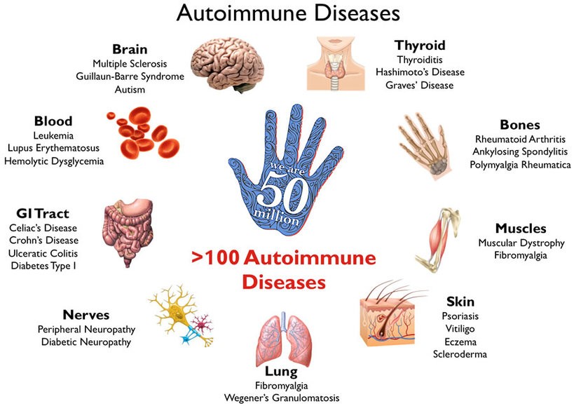 Are Rh negatives more likely to suffer from autoimmune disorders?