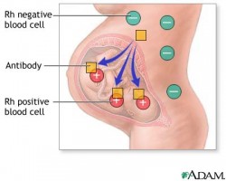 What are the chances of your baby being rh negative like you?