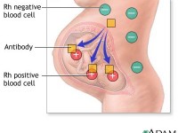 What are the chances of your baby being rh negative like you?