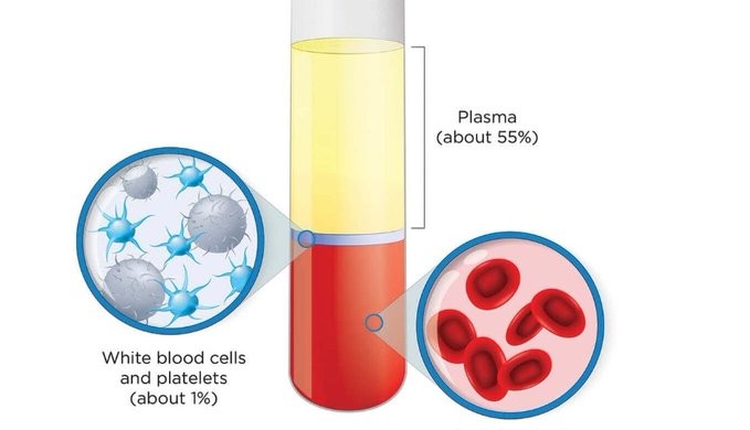 Hyperimmune serum is blood plasma containing high amounts of an antibody. It has been hypothesised that hyperimmune serum may be an effective therapy for persons infected with the Ebola virus.