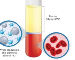 Hyperimmune serum is blood plasma containing high amounts of an antibody. It has been hypothesised that hyperimmune serum may be an effective therapy for persons infected with the Ebola virus.